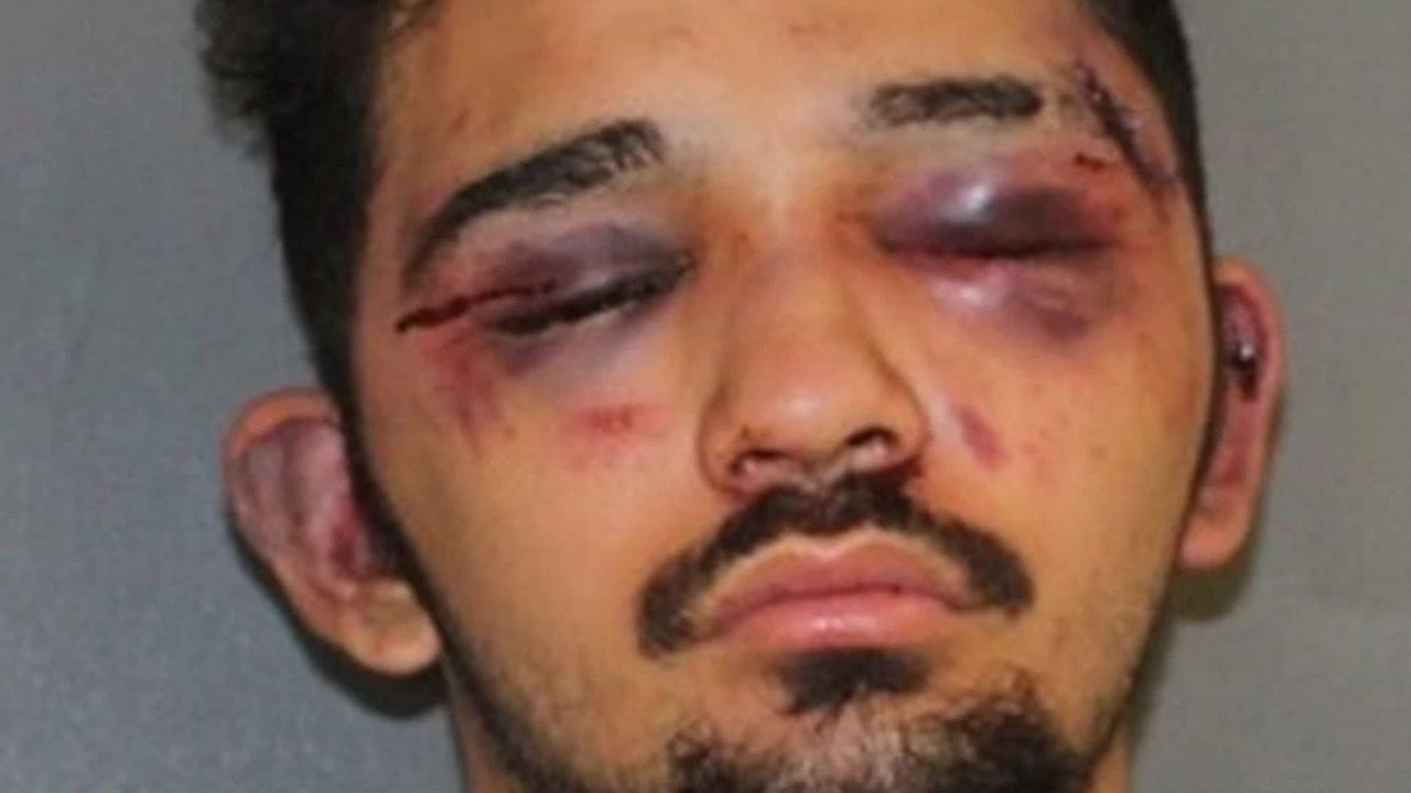 Texas man hospitalized after robbery attempt