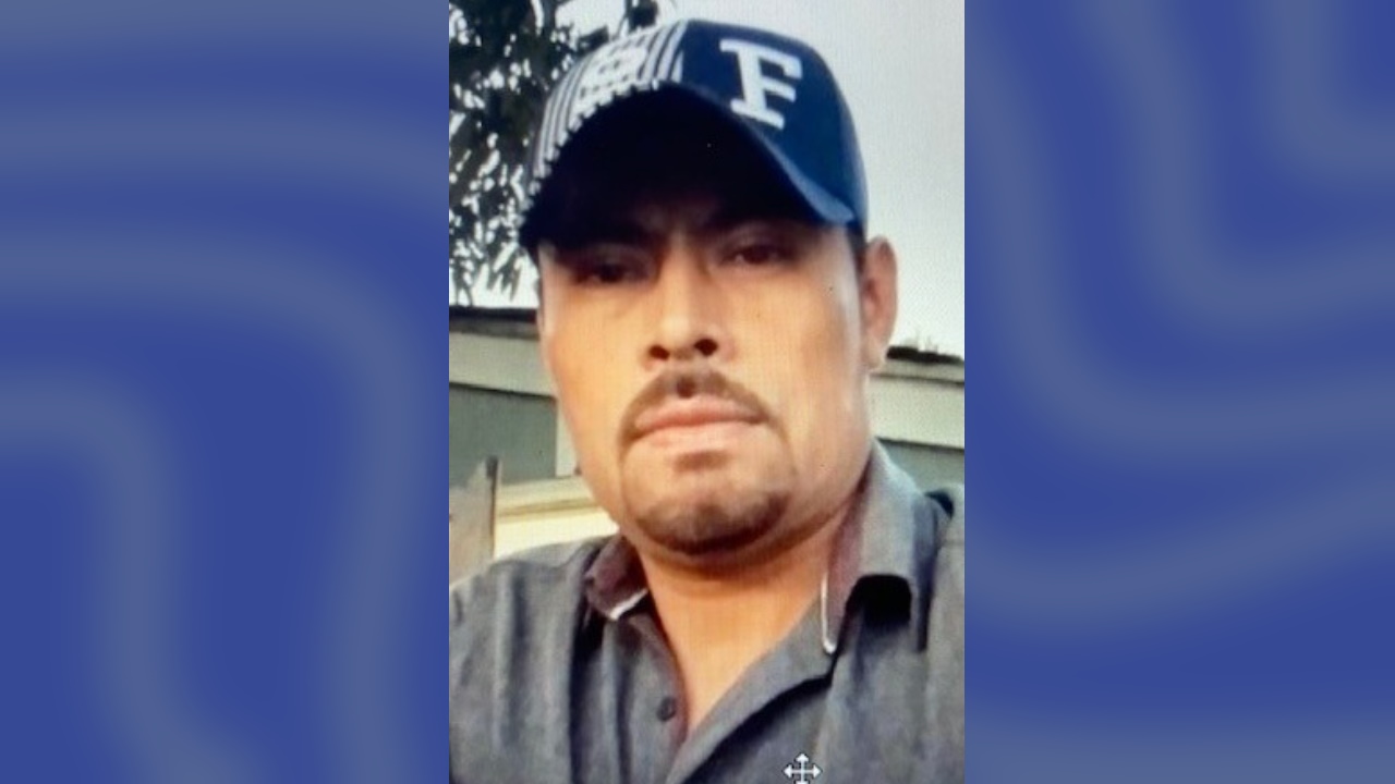 Man accused of burning girlfriend