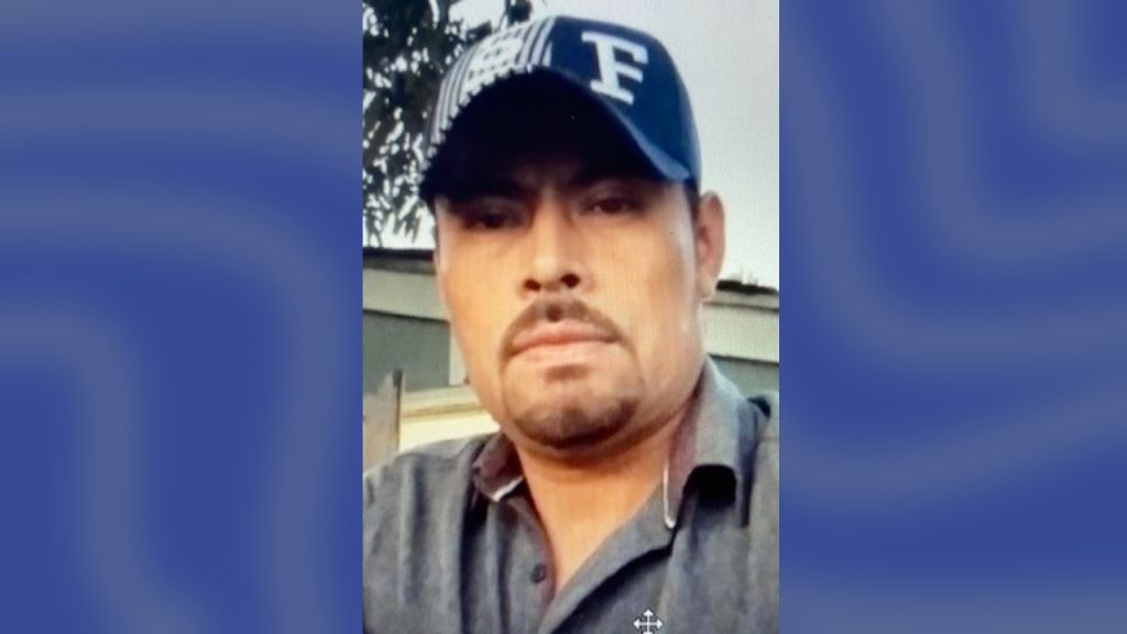 Man accused of burning girlfriend