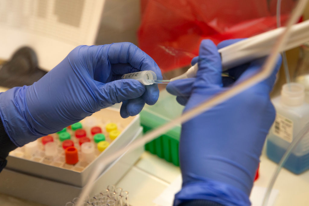 University Of Washington Medicine Tests Blood Of Recovered COVID-19 Patients For Antibodies