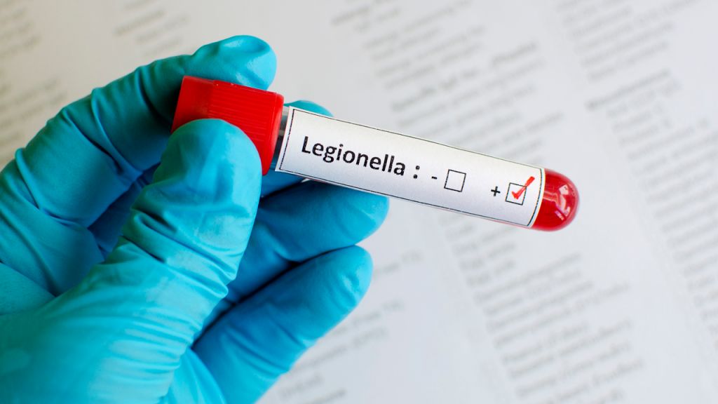 California Legionnaires' disease outbreak: 1 dead after 12 hospitalized in Napa County